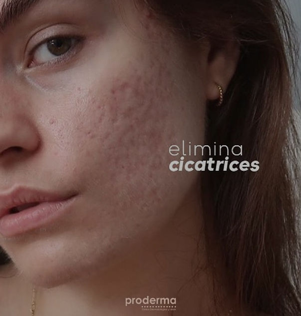 Proderma, dermatología, estética, salud, Tampico