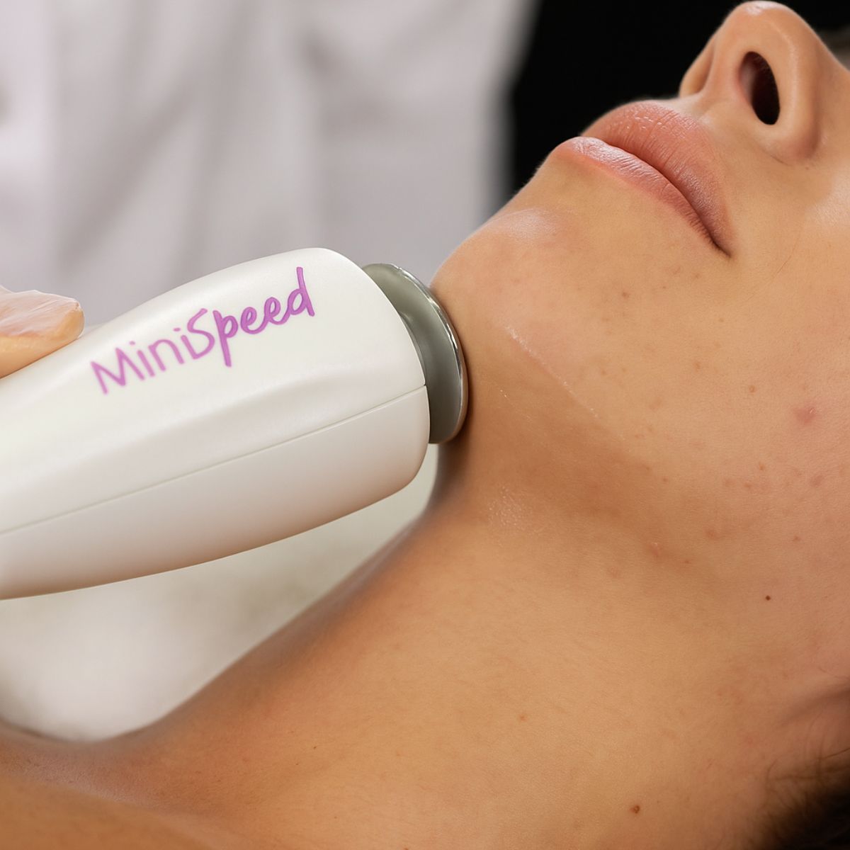 Proderma,  dermatología,  minispeed, tratamiento estético,  clínica