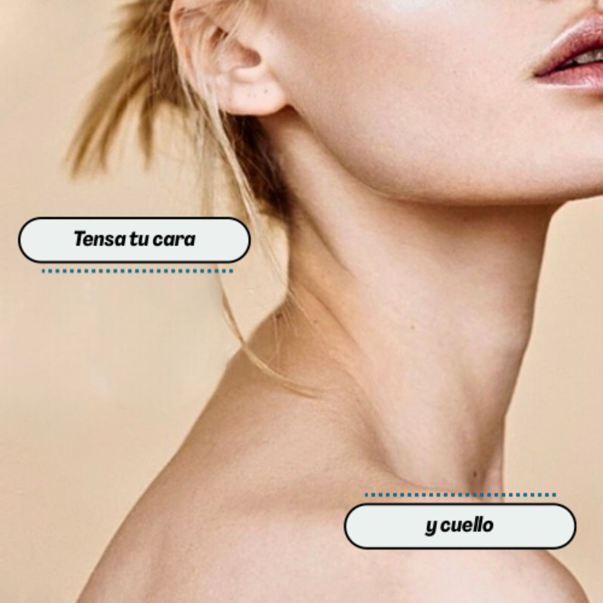 Proderma,  dermatología,  accentxl, flacidez, firmeza, clínica 