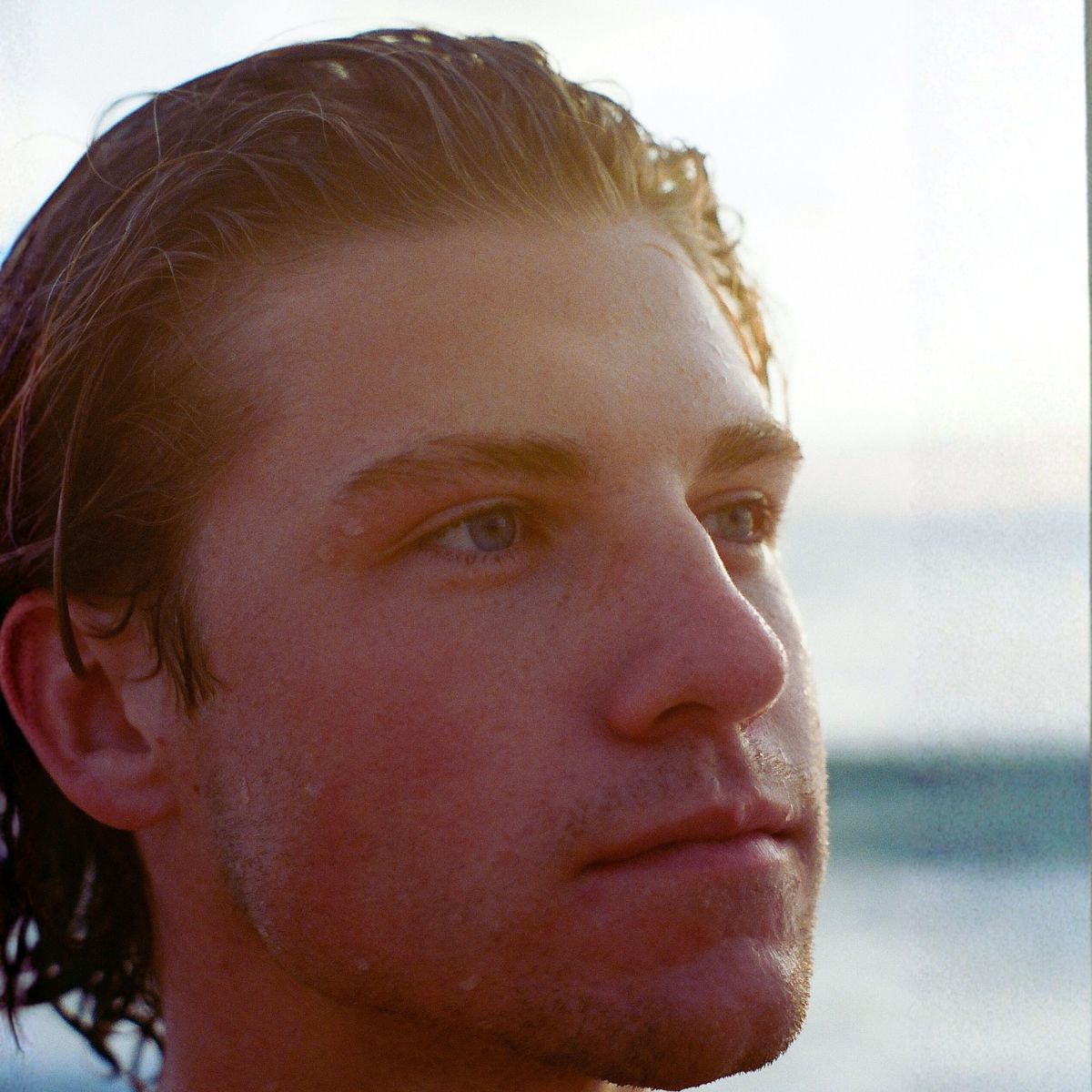 Caída del cabello, alopecia