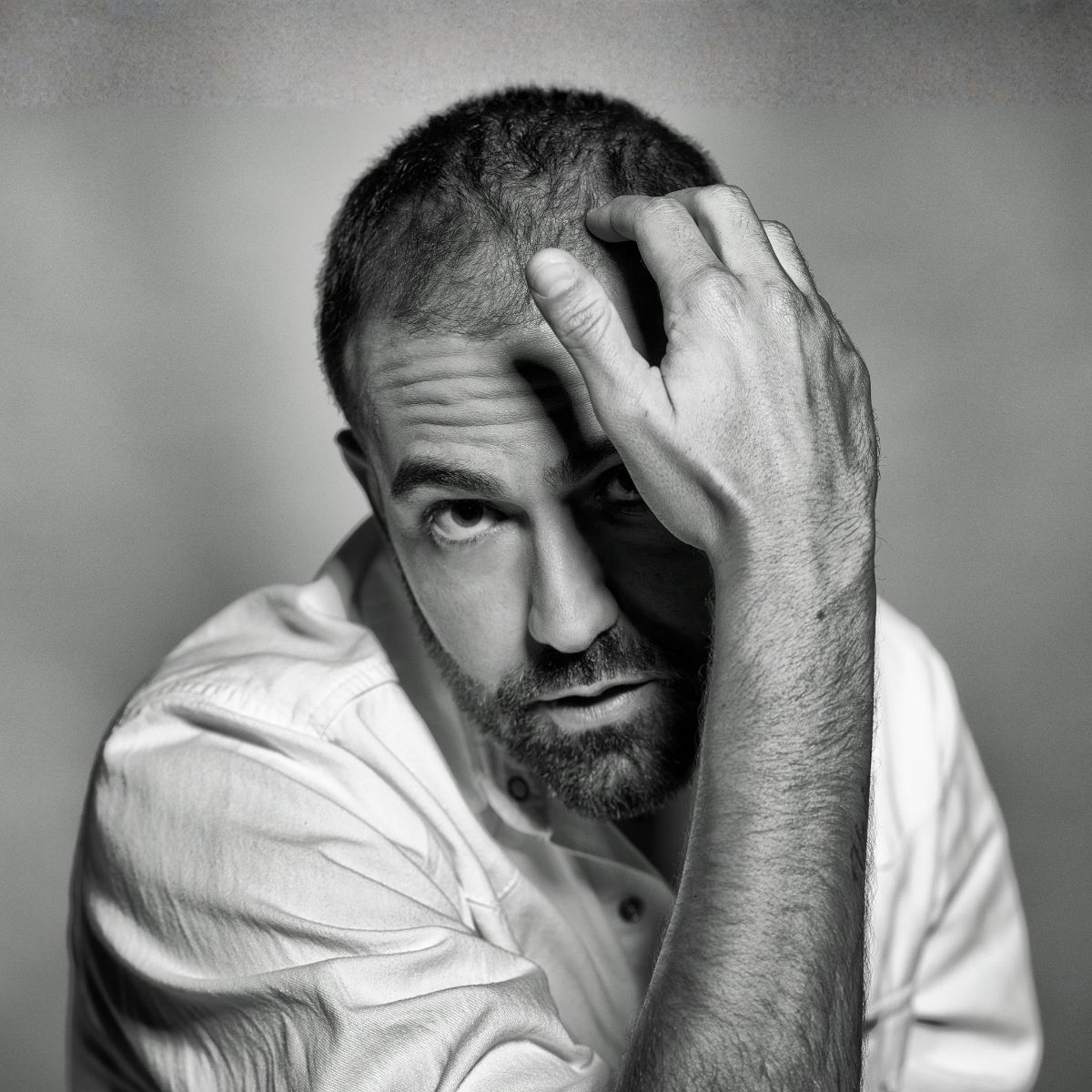 Proderma, alopecia, clínica, dermatología 