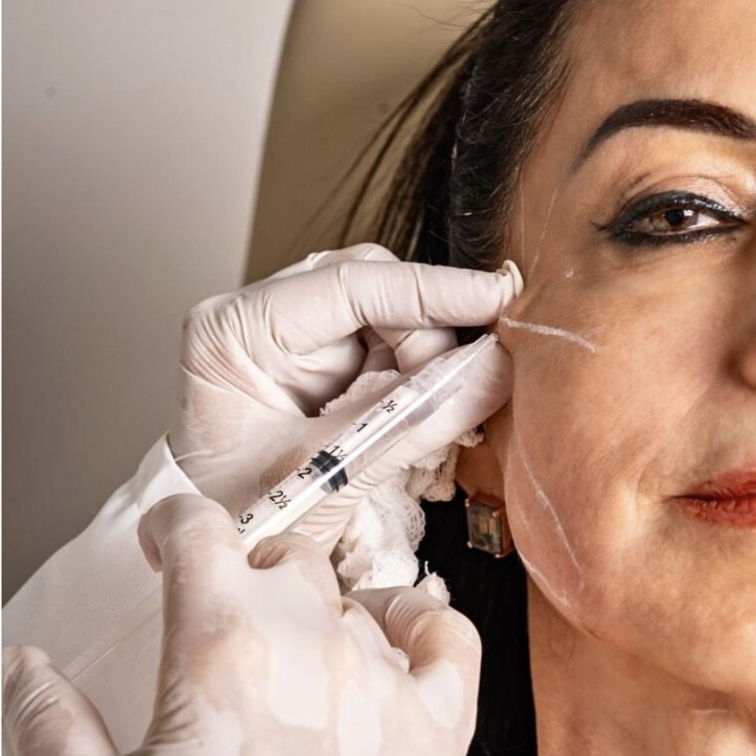 Proderma, dermatología, colágeno, bioestimulantes, elasticidad, clínica, Sculptra, Lenisna, Juvelook, Ovidia, Radiesse, Ultracol 