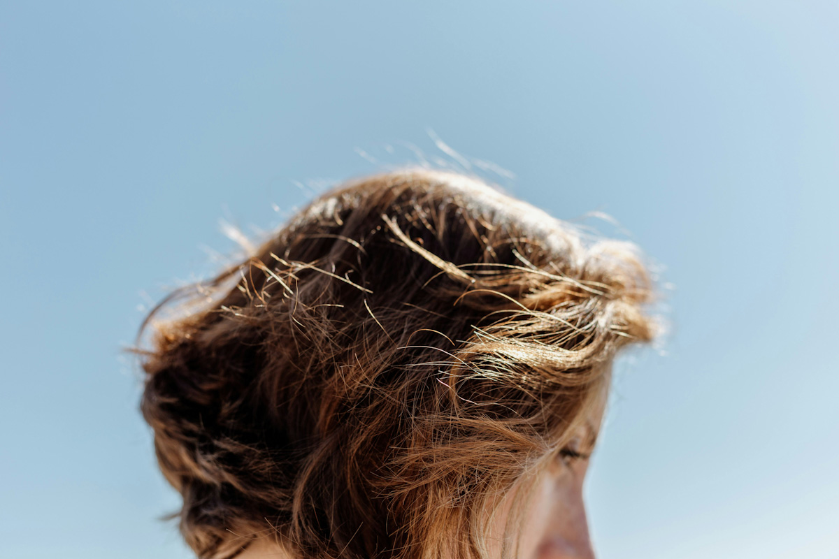 Proderma, alopecia, clínica, dermatología 