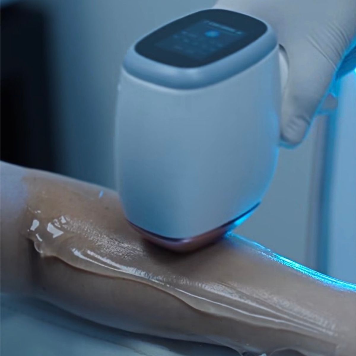 Proderma,  depilación,  dermatología,  clínica 