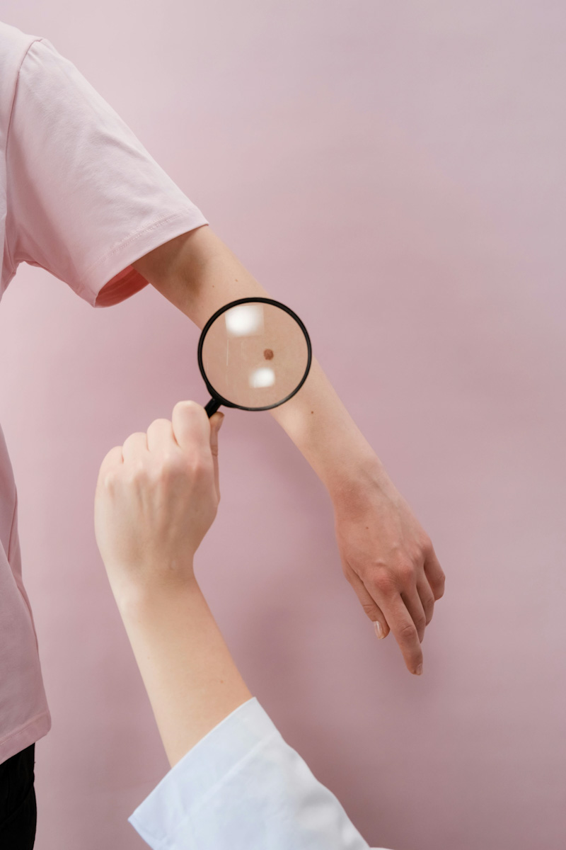 Proderma, dermatología,  Oncoquirúrgica,  dermatoscopía, clínica 