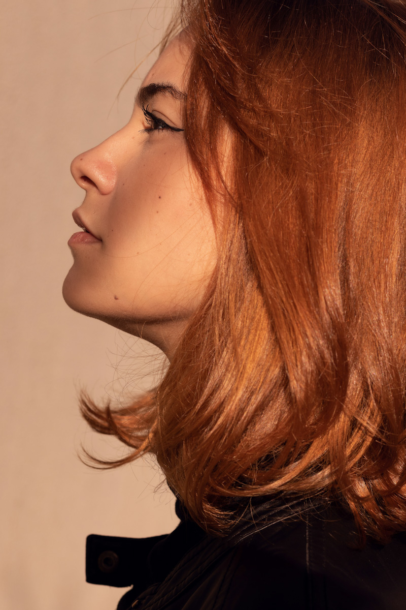 Proderma, dermatología,  clínica,  mentón, papada