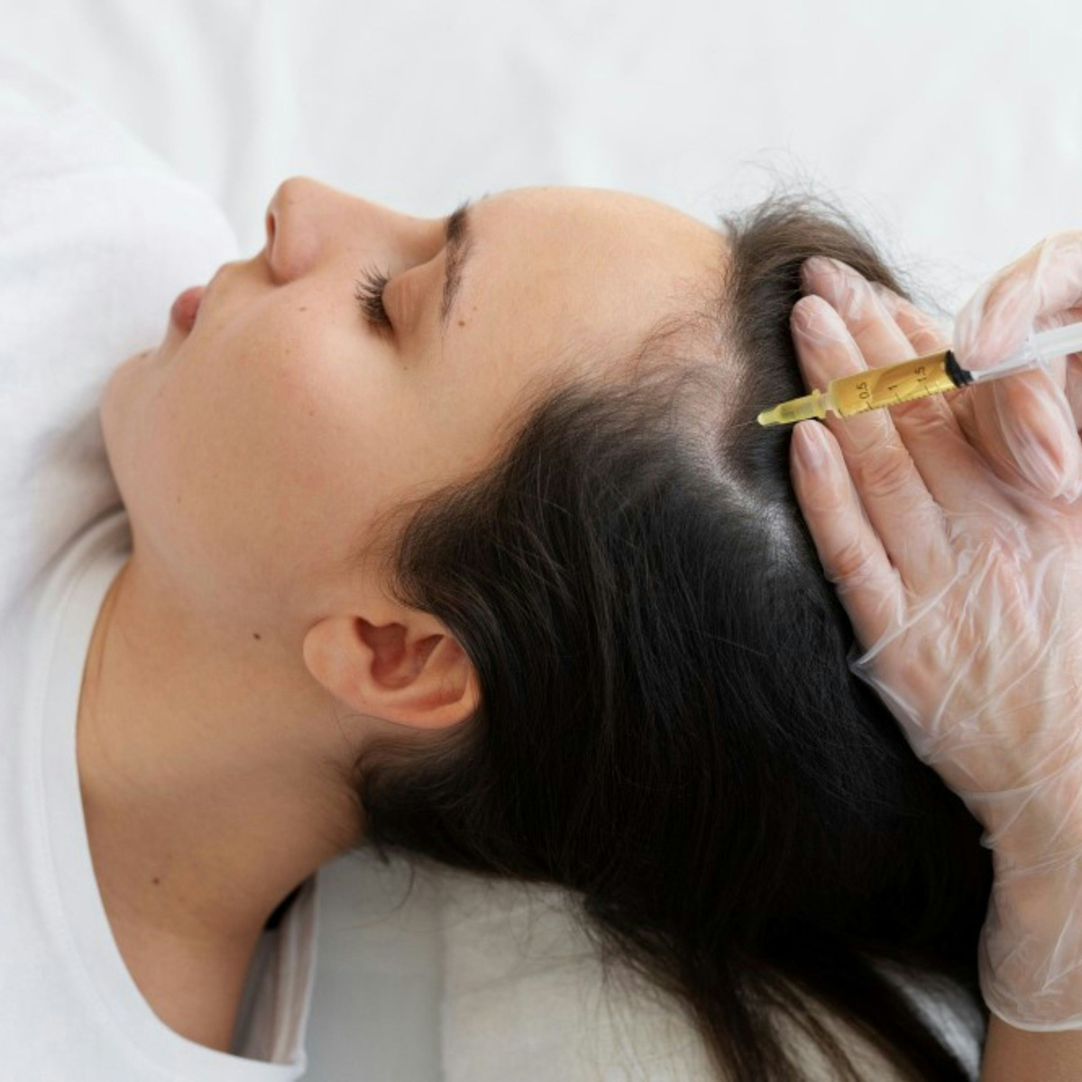 Proderma,  cabello, perdida de cabello, recuperar cabello, clínica, dermatología 