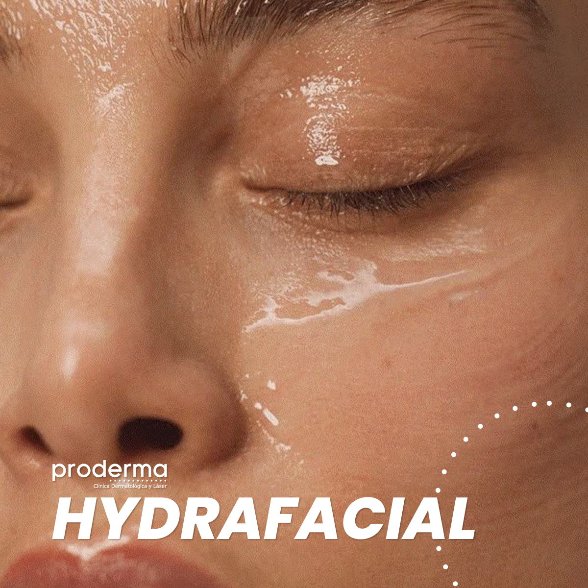 Proderma, dermatología,  hidrofacial, exfoliación, hidratación, luminosidad 