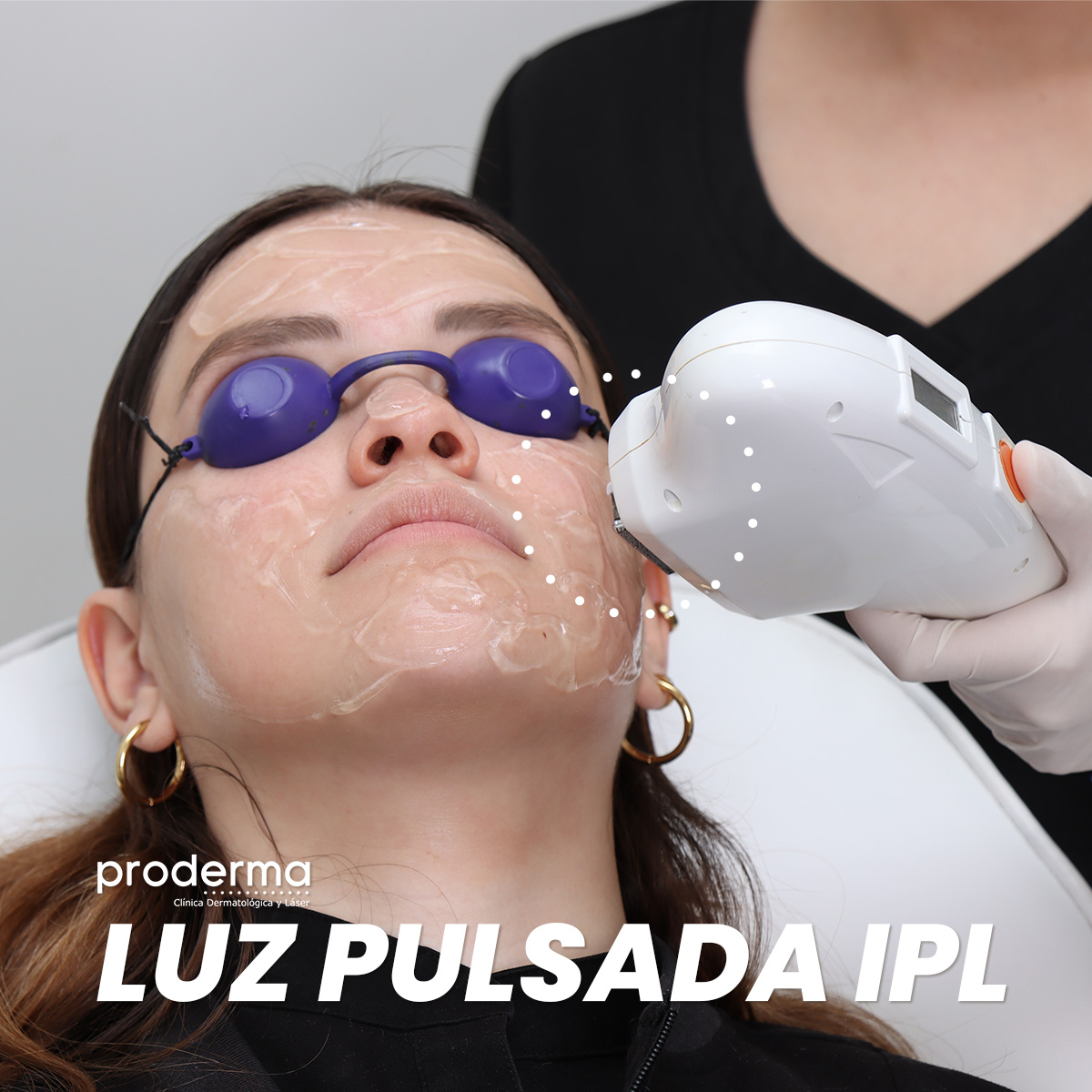 Proderma,  dermatología,  luz pulsada, tratamient estéticos, enrojecimiento,  rejuvenecimiento 