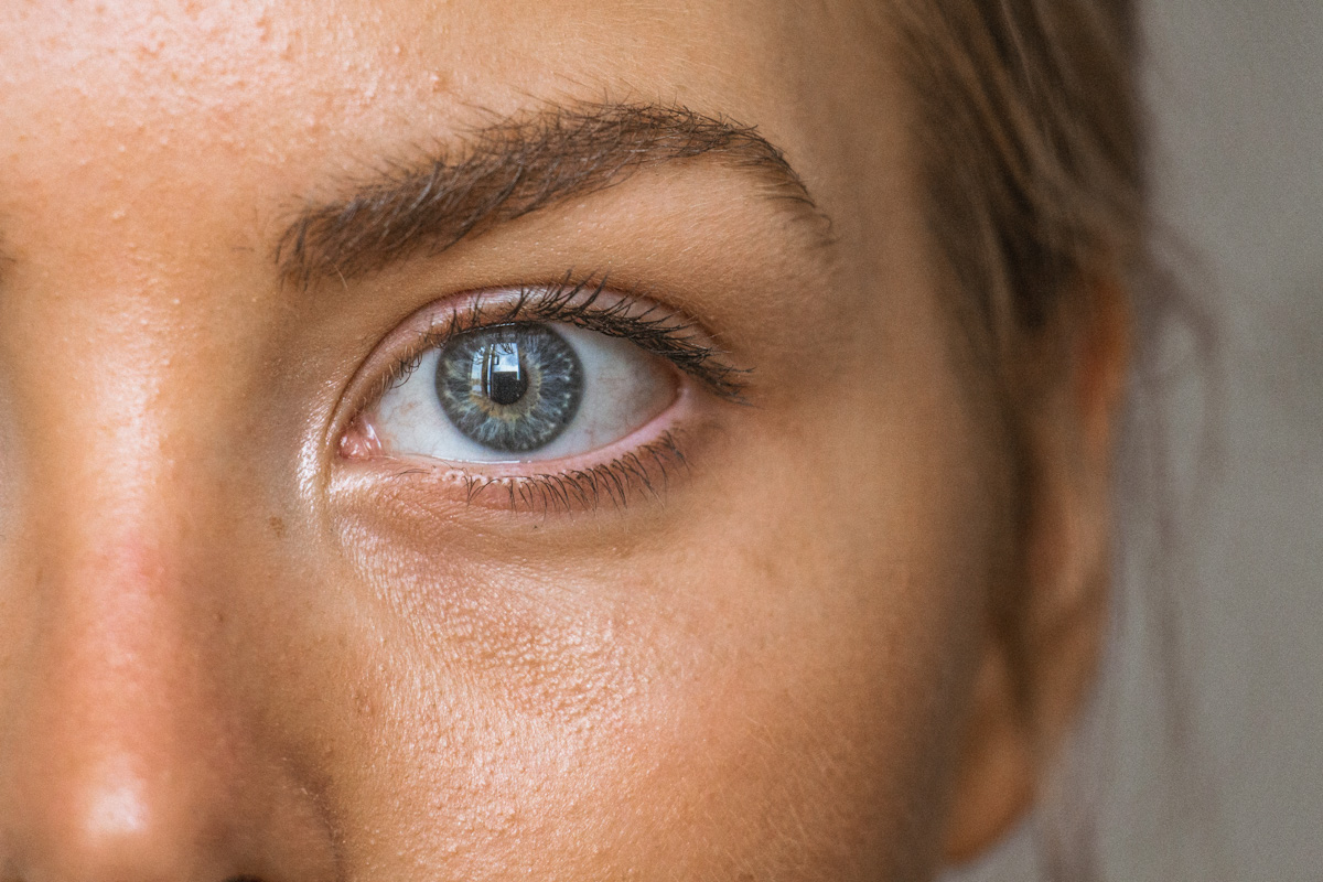Proderma, dermatología,  despigmentación, correción de arrugas, clínica